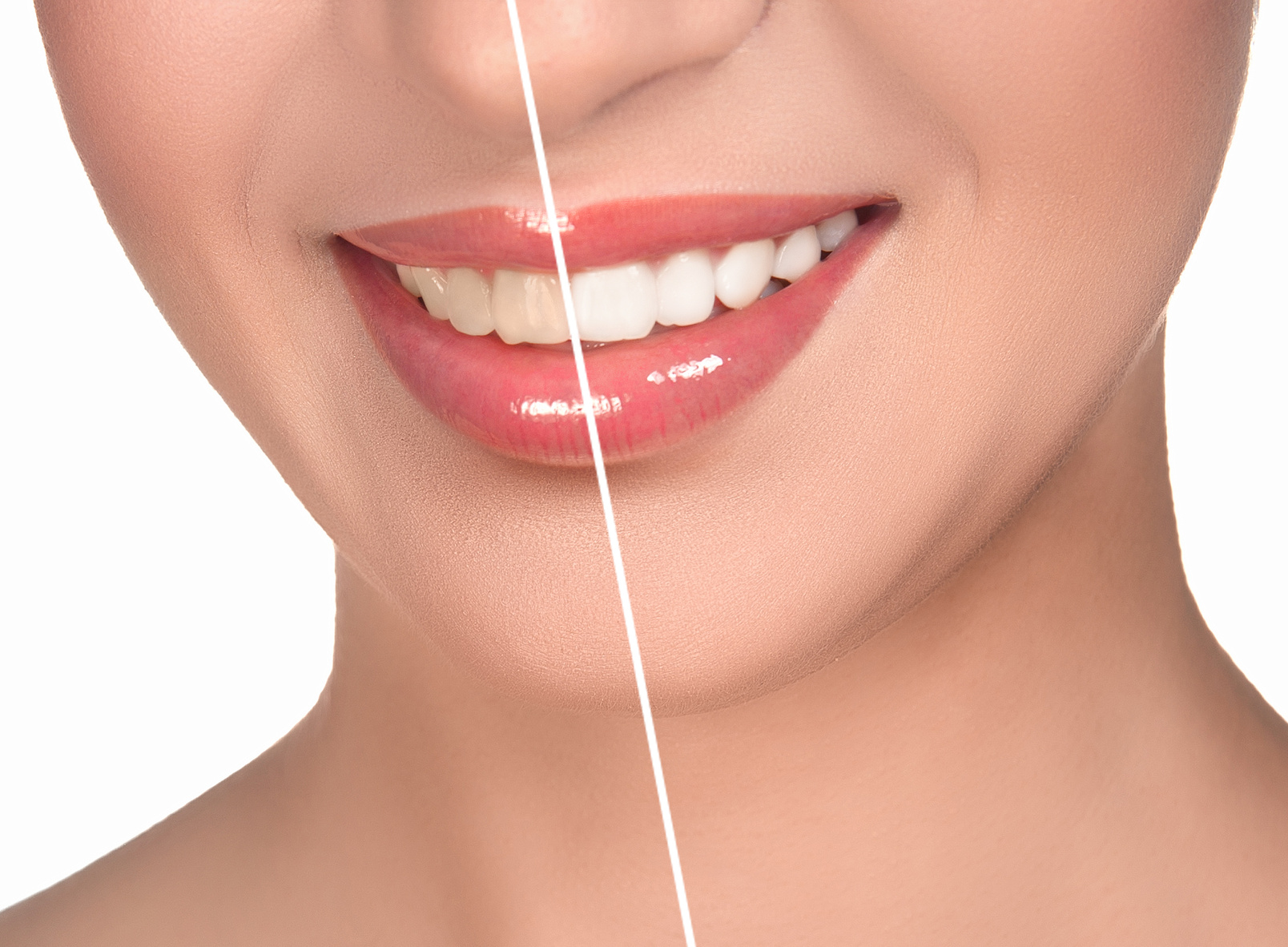 Healthy teen mouth